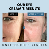 Under Eye Cream for Dark Circles & Puffiness