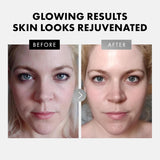 Vitamin C, Retinol, Hyaluronic Acid - 3 Pack Face Care Set