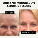 Anti Wrinkle Eye Serum for Dark Circles