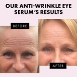 Anti Wrinkle Eye Serum for Dark Circles