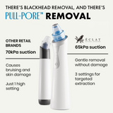 Blackhead Removal Vacuum - Eclat